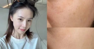 "5 serum giúp da hết nám, sáng mịn như 'bạch nguyệt quang' sau 30"