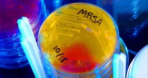 Kháng sinh mới mạnh gấp 100 lần: Hy vọng cho y học tương lai!