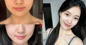 "5 sản phẩm làm trắng da, ngừa nám ai cũng yêu thích"