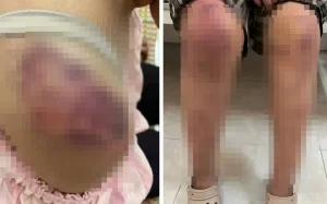 "Thái Nguyên: Điều tra vụ bé 12 tuổi bị ông bà nội hành hạ dã man"